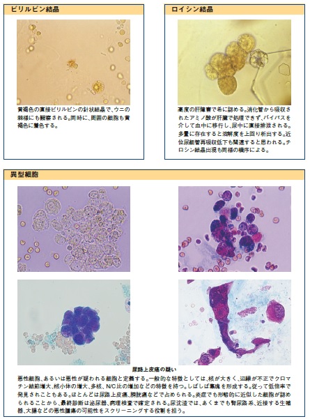 「尿沈渣」画像